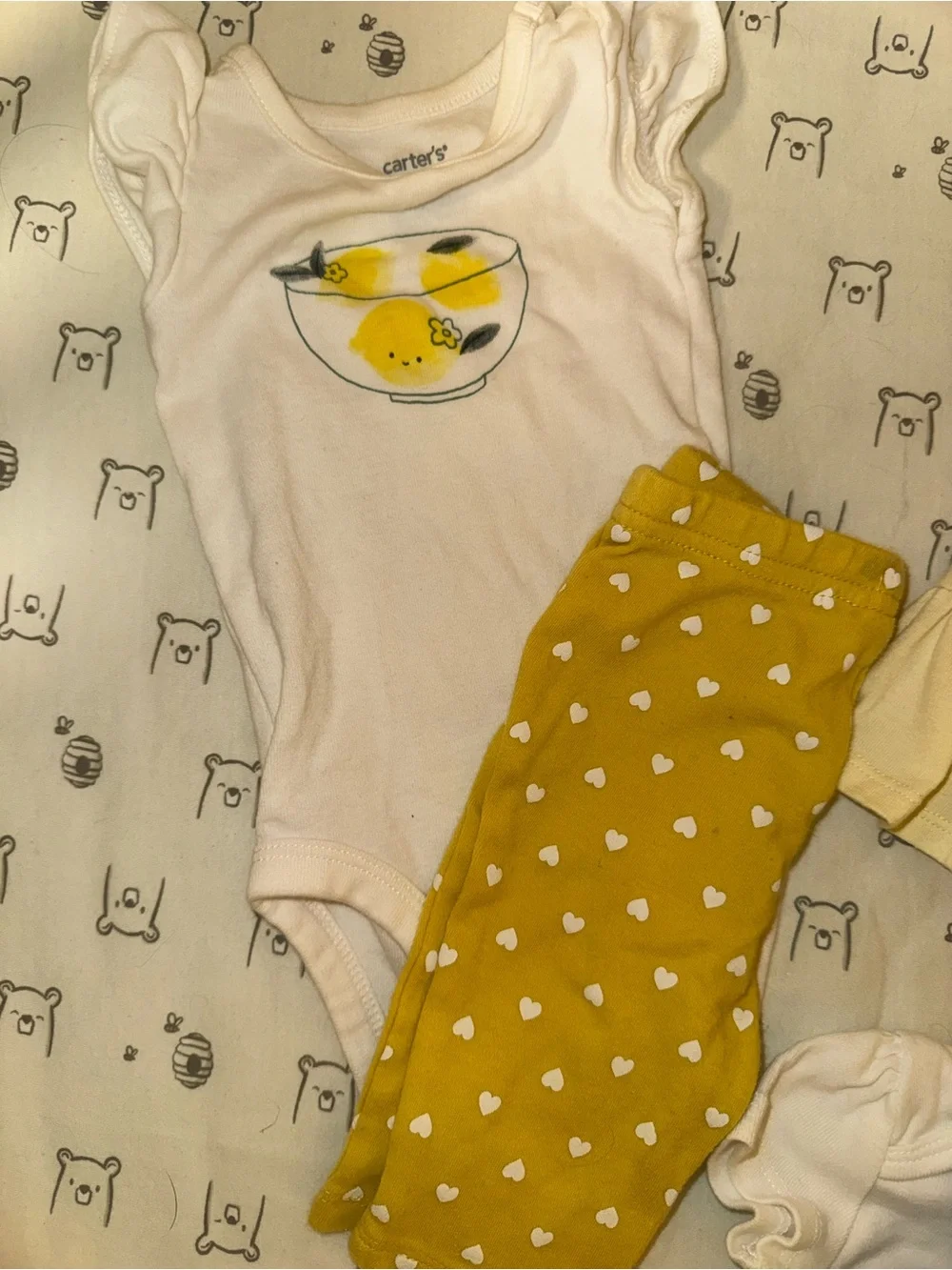 Baby Lemon Outfit Bundle